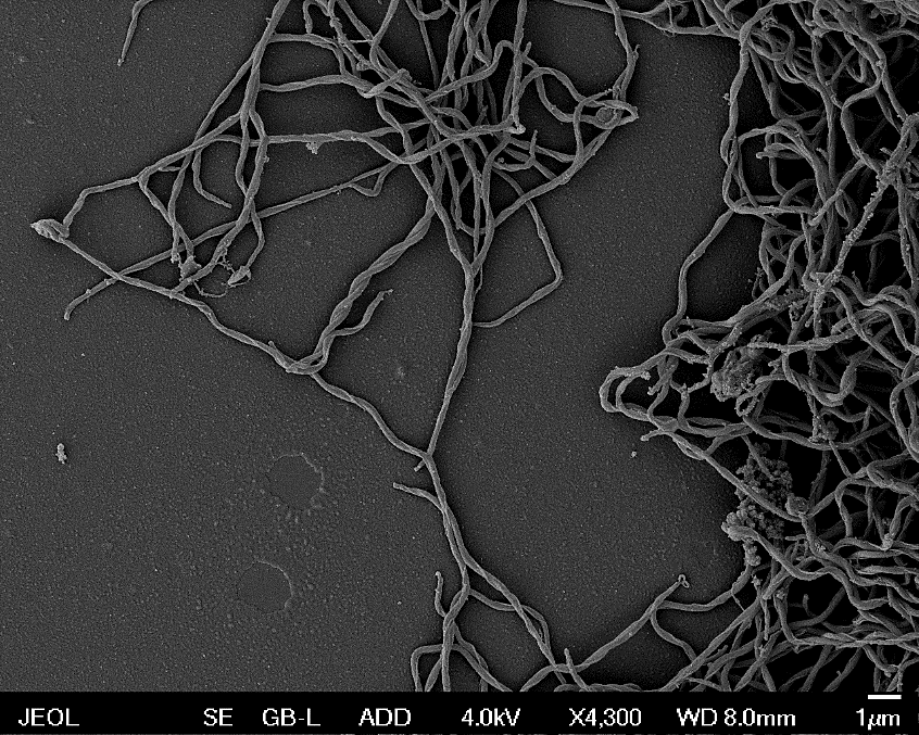 Spirochety z komplexu Borrelia burgdorferi sensu lato kultivované v MKP médií z klíště Ixodes ricinus (Scanning Electron Microscopy-SEM)